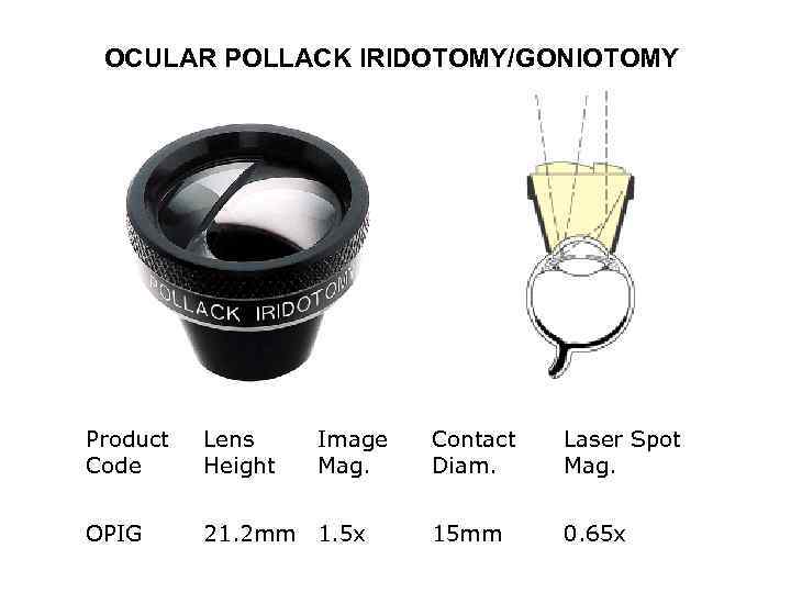 OCULAR POLLACK IRIDOTOMY/GONIOTOMY Product Code Lens Height Image Mag. OPIG 21. 2 mm 1.