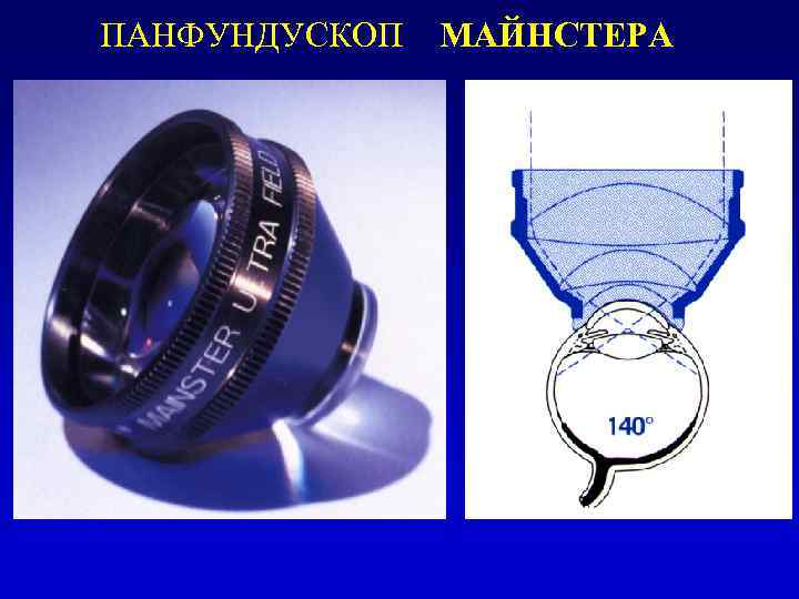 ПАНФУНДУСКОП МАЙНСТЕРА 