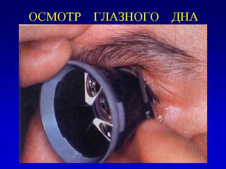 ОСМОТР ГЛАЗНОГО ДНА 