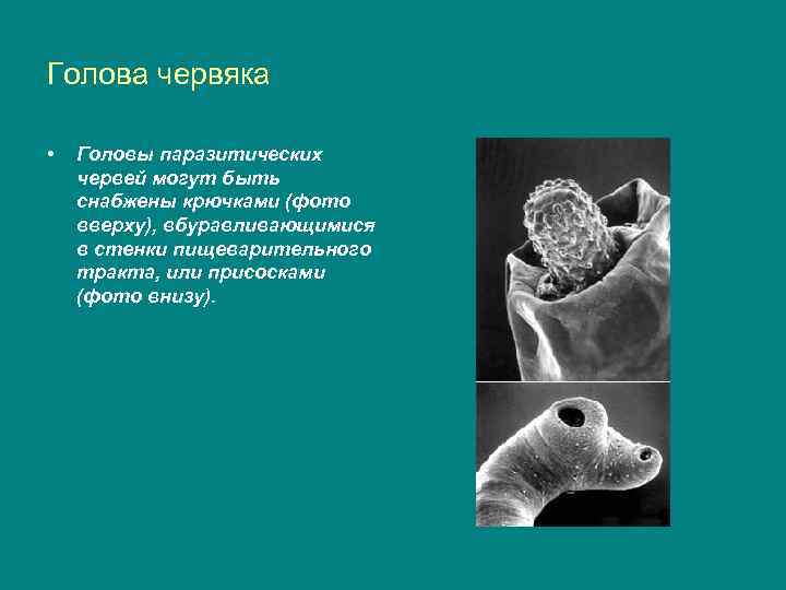 Голова червяка • Головы паразитических червей могут быть снабжены крючками (фото вверху), вбуравливающимися в