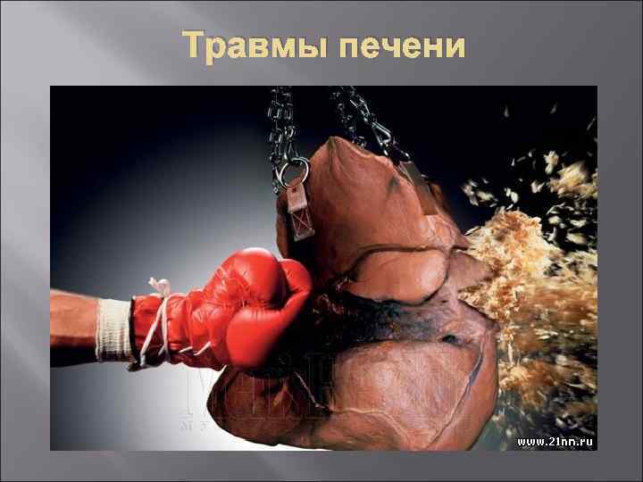Травмы печени 