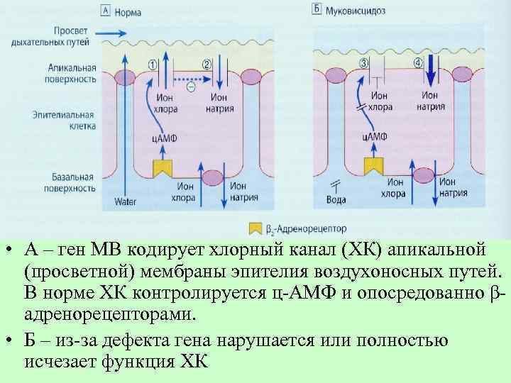 • А – ген МВ кодирует хлорный канал (ХК) апикальной (просветной) мембраны эпителия