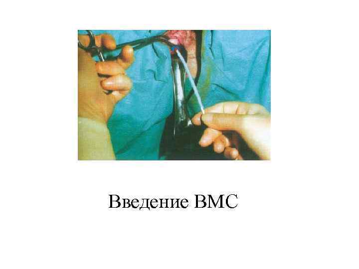 Введение ВМС 