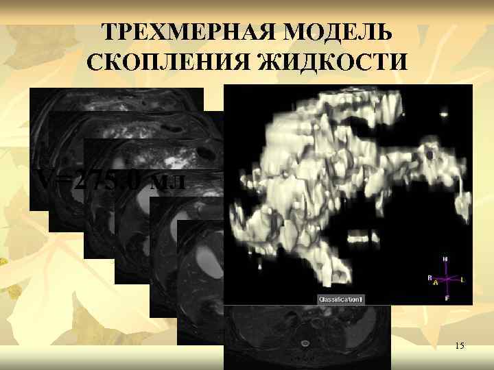 ТРЕХМЕРНАЯ МОДЕЛЬ СКОПЛЕНИЯ ЖИДКОСТИ V=275. 0 мл 15 