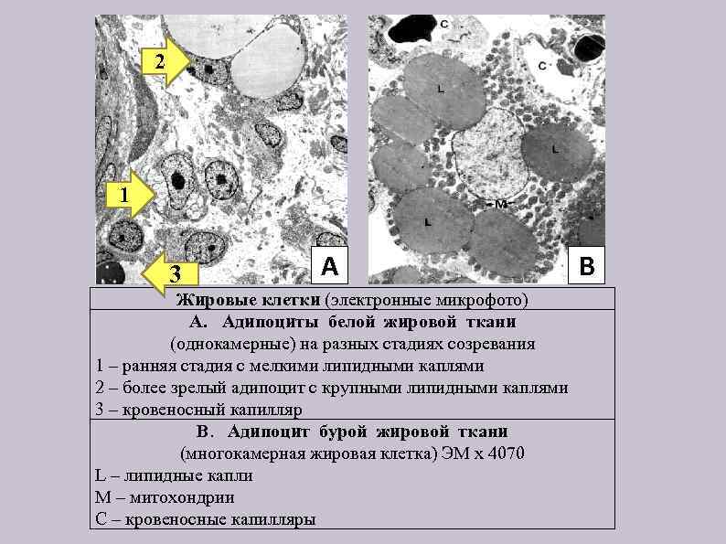 2 1 3 A Жировые клетки (электронные микрофото) A. Адипоциты белой жировой ткани (однокамерные)