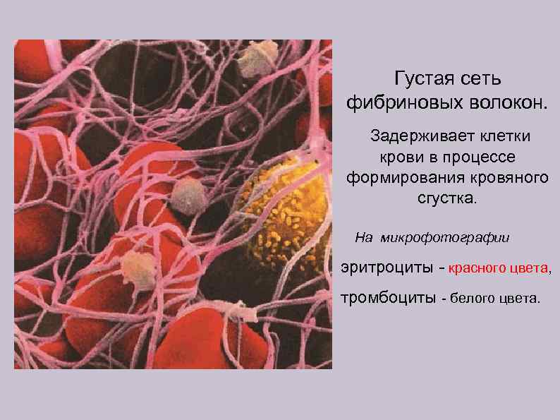 Густая сеть фибриновых волокон. Задерживает клетки крови в процессе формирования кровяного сгустка. На микрофотографии