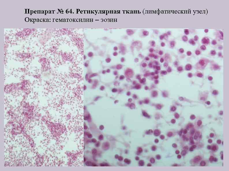 Препарат № 64. Ретикулярная ткань (лимфатический узел) Окраска: гематоксилин – эозин 