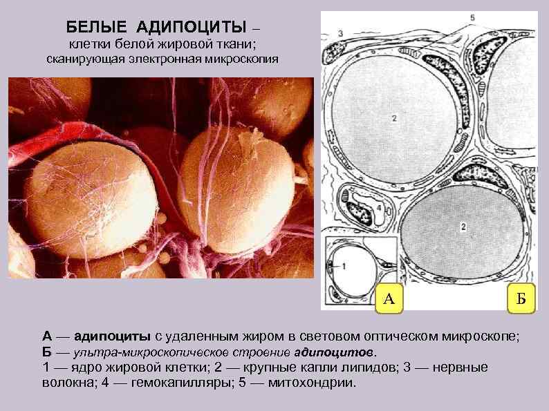 БЕЛЫЕ АДИПОЦИТЫ – клетки белой жировой ткани; сканирующая электронная микроскопия А Б А —