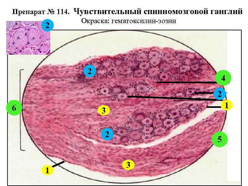 Препарат № 114. Чувствительный спинномозговой ганглий Окраска: гематоксилин-эозин 2 2 4 2 6 1
