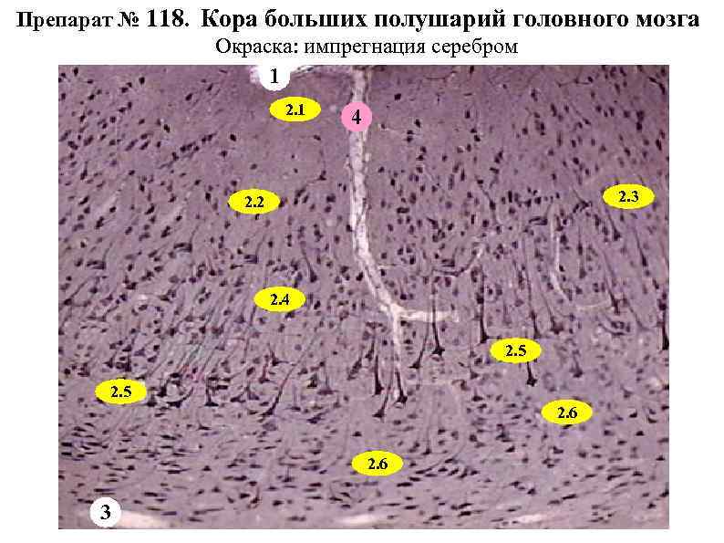 Гистология мозга. Кора больших полушарий головного мозга импрегнация серебром. Препарат кора больших полушарий импрегнация серебром. Кора большого мозга импрегнация серебром гистология. Кора головного мозга препарат гистология импрегнация.