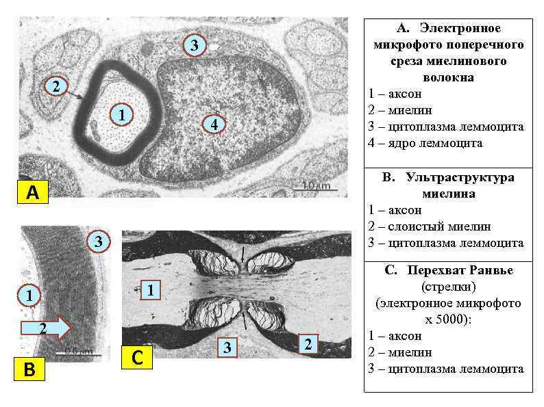 A. Электронное микрофото поперечного среза миелинового волокна 1 – аксон 2 – миелин 3
