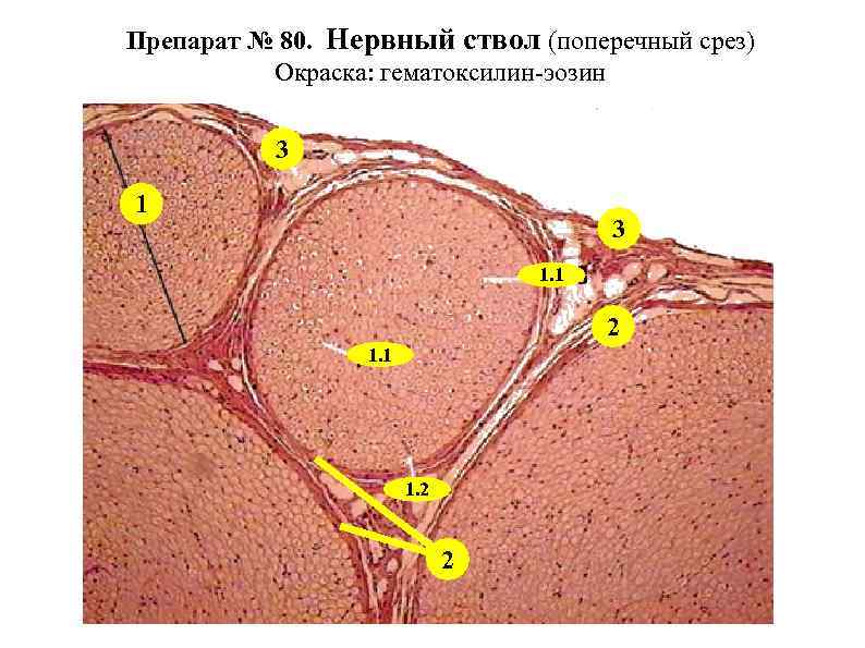 Препарат № 80. Нервный ствол (поперечный срез) Окраска: гематоксилин-эозин 3 1. 1 2 1.