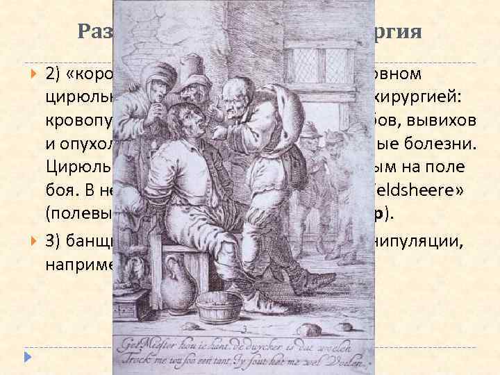 Развитие врачевания. Хирургия 2) «короткополые» хирурги были в основном цирюльниками и занимались «малой» хирургией: