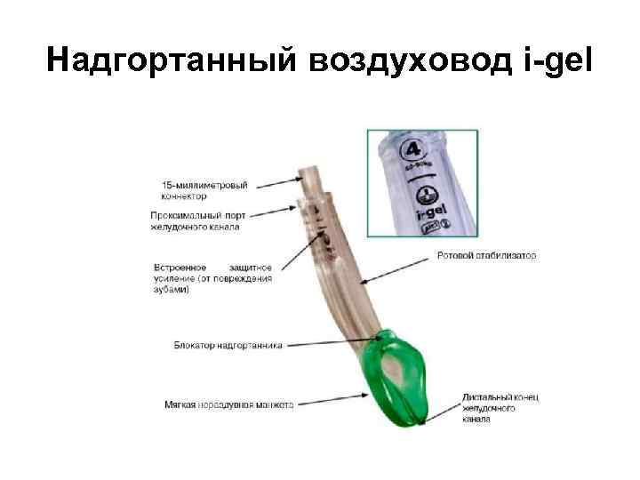 Надгортанный воздуховод i-gel 