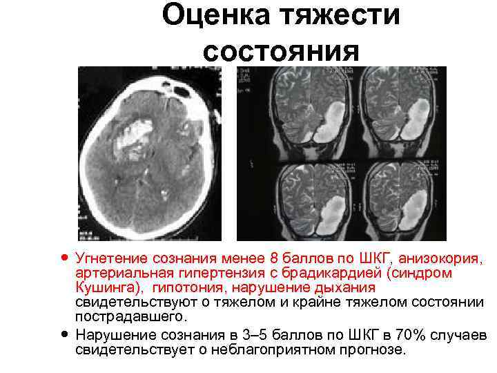 Оценка тяжести состояния Угнетение сознания менее 8 баллов по ШКГ, анизокория, артериальная гипертензия с