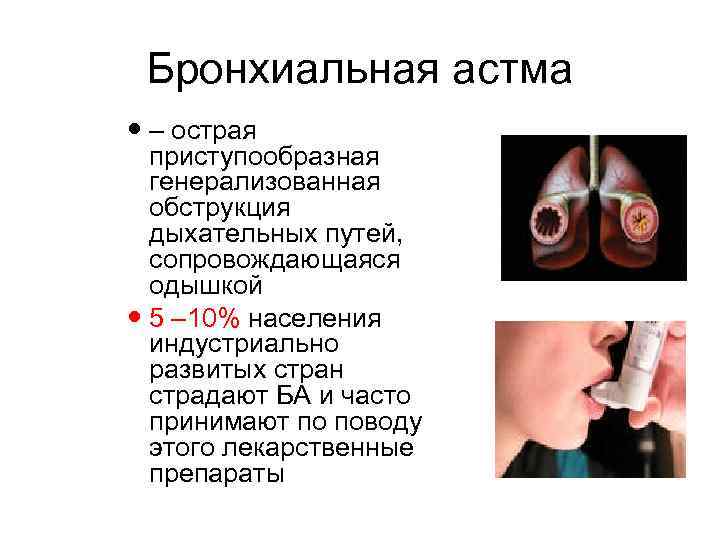 Бронхиальная астма – острая приступообразная генерализованная обструкция дыхательных путей, сопровождающаяся одышкой 5 – 10%