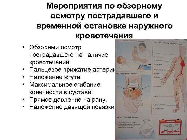 Мероприятия по обзорному осмотру пострадавшего и временной остановке наружного кровотечения • Обзорный осмотр пострадавшего