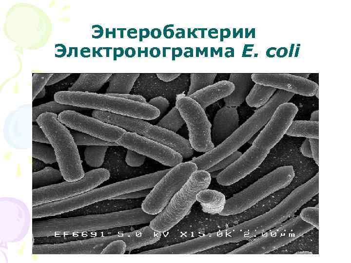 Энтеробактерии Электронограмма E. coli 