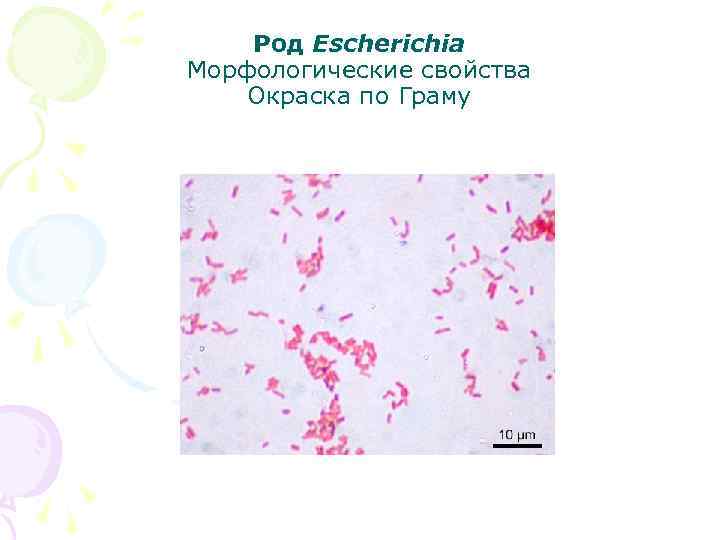 Род Escherichia Морфологические свойства Окраска по Граму 