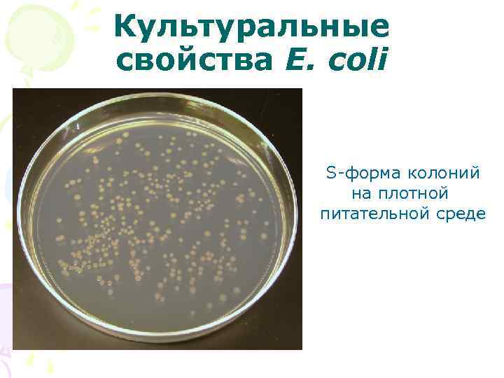 Культуральные свойства E. coli S-форма колоний на плотной питательной среде 