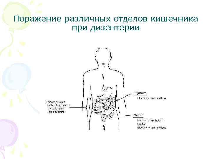 Поражение различных отделов кишечника при дизентерии 