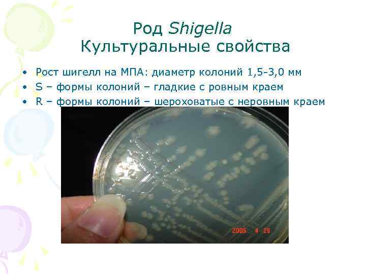 Род Shigella Культуральные свойства • Рост шигелл на МПА: диаметр колоний 1, 5 -3,