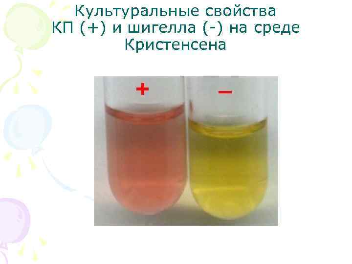 Культуральные свойства КП (+) и шигелла (-) на среде Кристенсена 