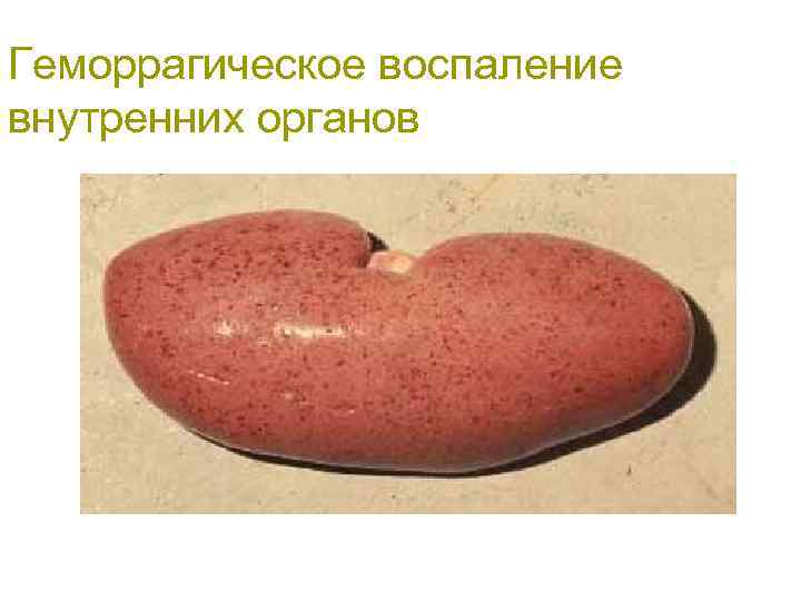 Геморрагическое воспаление внутренних органов 