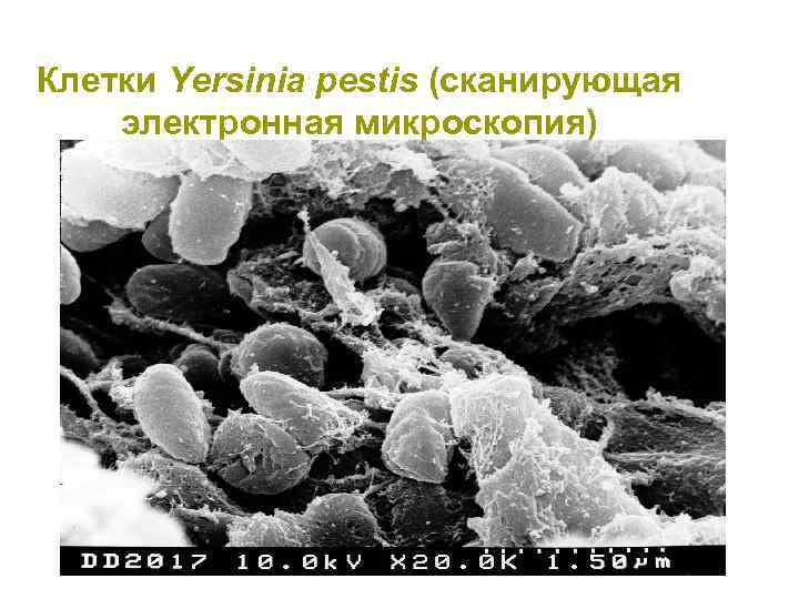 Клетки Yersinia pestis (сканирующая электронная микроскопия) 