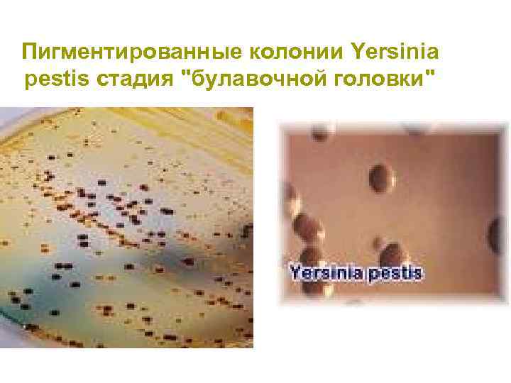 Пигментированные колонии Yersinia pestis стадия "булавочной головки" 