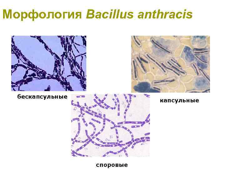 Морфология Bacillus anthracis бескапсульные споровые 