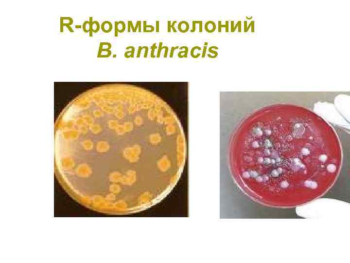 Формы колоний. Колонии s и r формы. S И R формы бактерий. R S колонии бактерий. R форма колоний.