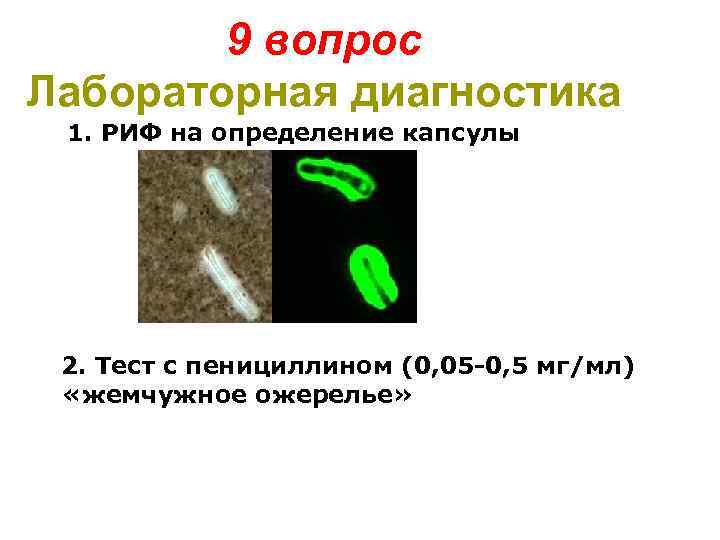 9 вопрос Лабораторная диагностика 1. РИФ на определение капсулы 2. Тест с пенициллином (0,