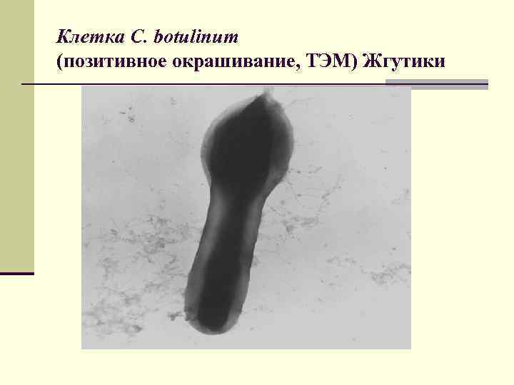 Клетка C. botulinum (позитивное окрашивание, ТЭМ) Жгутики 