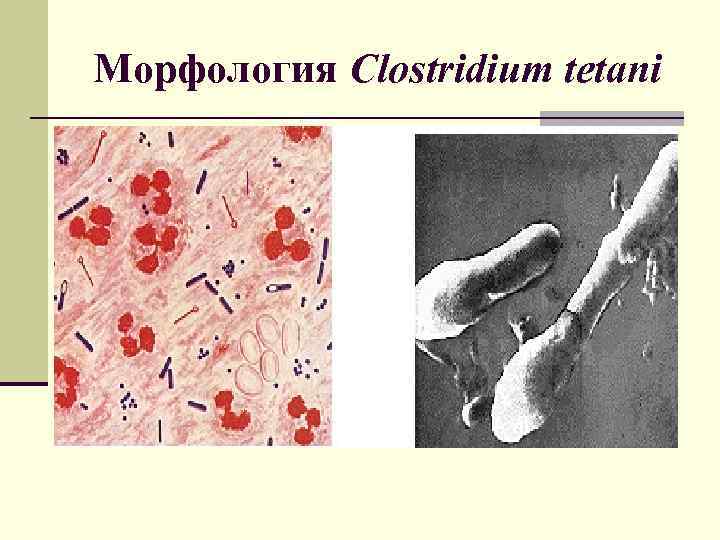 Морфология Clostridium tetani 