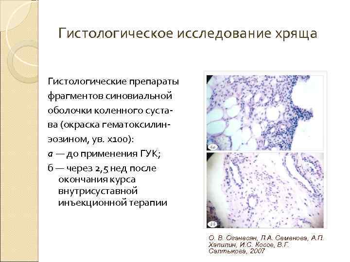 Гистологическое исследование хряща Гистологические препараты фрагментов синовиальной оболочки коленного сустава (окраска гематоксилинэозином, ув. х100):
