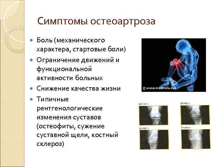 Симптомы остеоартроза Боль (механического характера, стартовые боли) Ограничение движений и функциональной активности больных Снижение