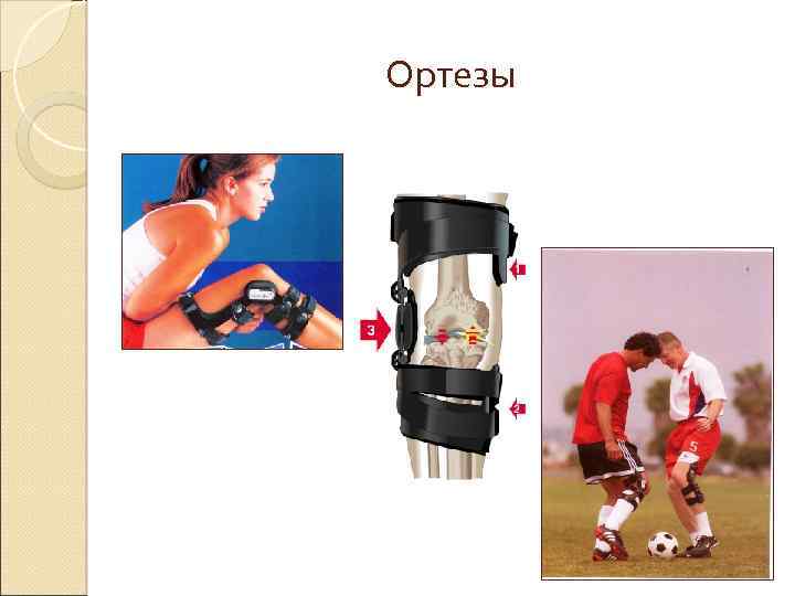 Ортезы 