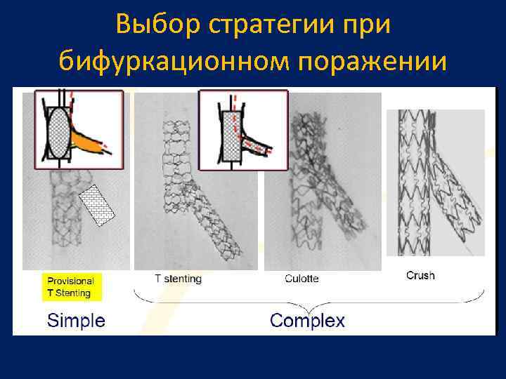 Выбор стратегии при бифуркационном поражении 