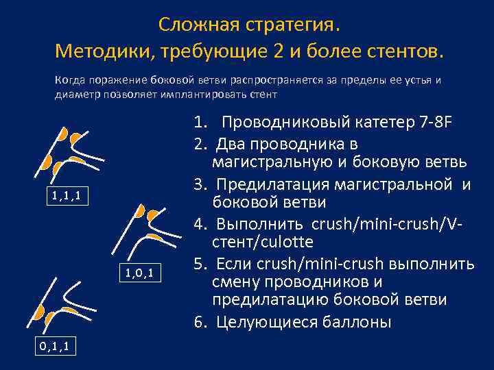 Сложная стратегия. Методики, требующие 2 и более стентов. Когда поражение боковой ветви распространяется за