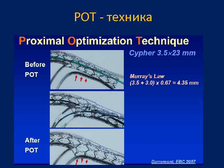POT - техника 