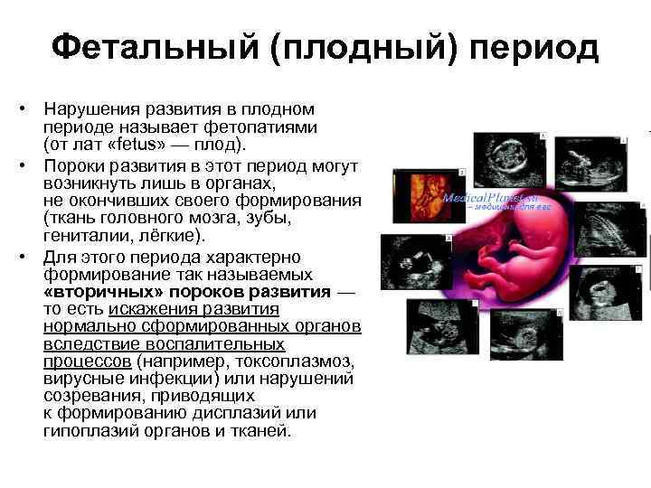 Фетальный (плодный) период • Нарушения развития в плодном периоде называет фетопатиями (от лат «fetus»