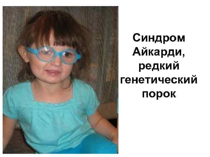 Синдром Айкарди, редкий генетический порок 