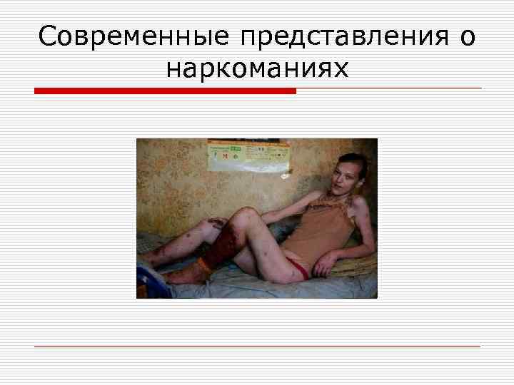 Современные представления о наркоманиях 