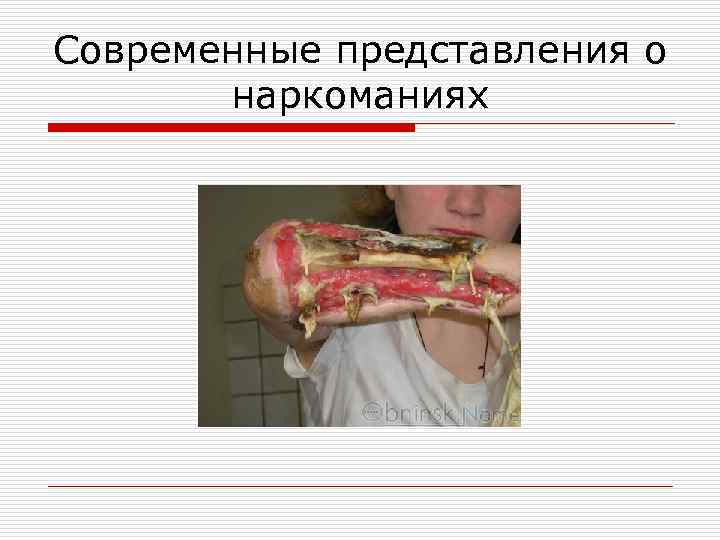 Современные представления о наркоманиях 