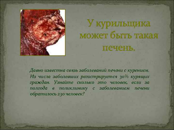  У курильщика может быть такая печень. Давно известна связь заболеваний печени с курением.