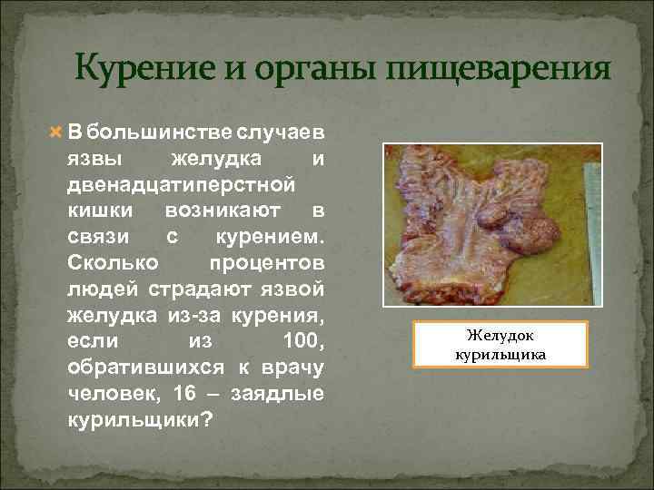  Курение и органы пищеварения В большинстве случаев язвы желудка и двенадцатиперстной кишки возникают