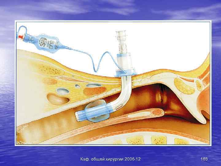 Каф. общей хирургии 2006 -12 165 