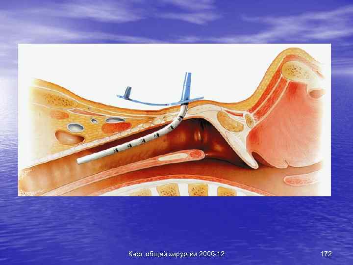 Каф. общей хирургии 2006 -12 172 