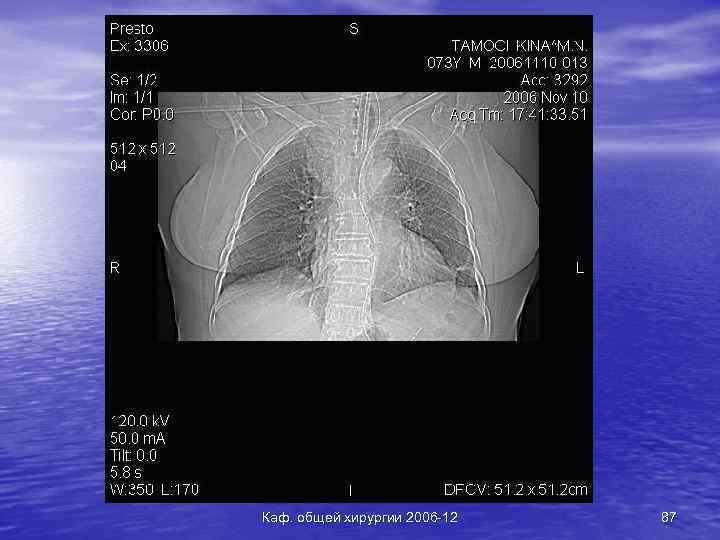 Каф. общей хирургии 2006 -12 87 